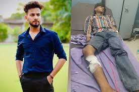  यूटयूबर एल्विश यादव के घर फायरिंग करने का आरोपी मुठभेड़ में गोली लगने से घायल